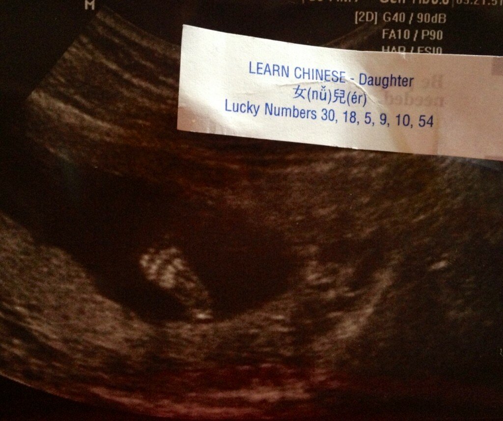 it's a girl daughter